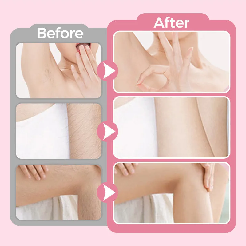 💥Hot Sale💥Dual-side Nano Skin Perfect Tool